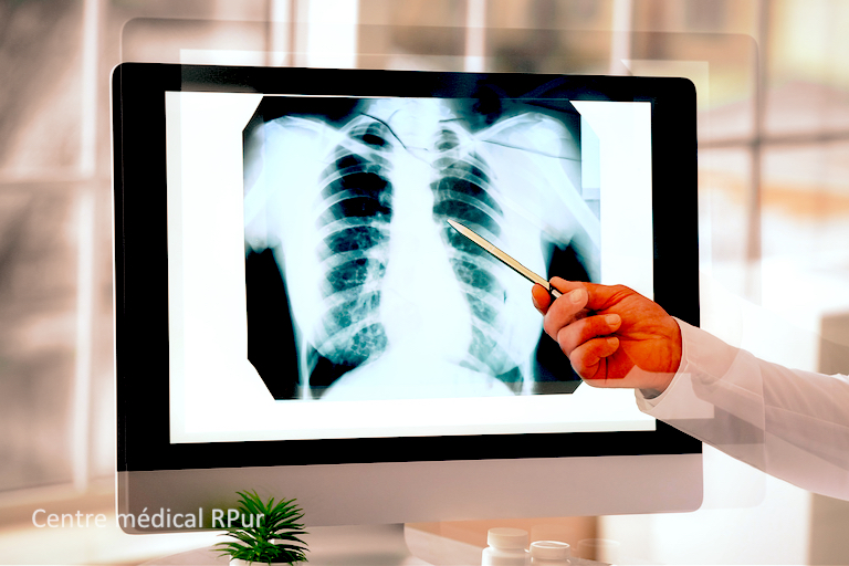 Pneumologie